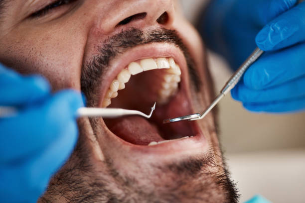 Best Urgent Tooth Repair  in North Gates, NY