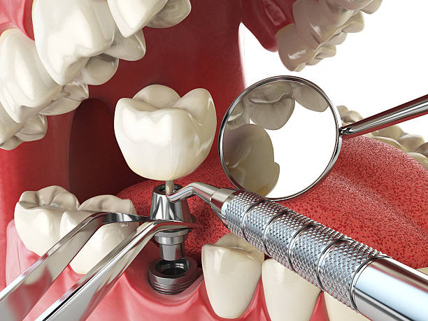 Best Dentist for Dental Trauma  in North Gates, NY